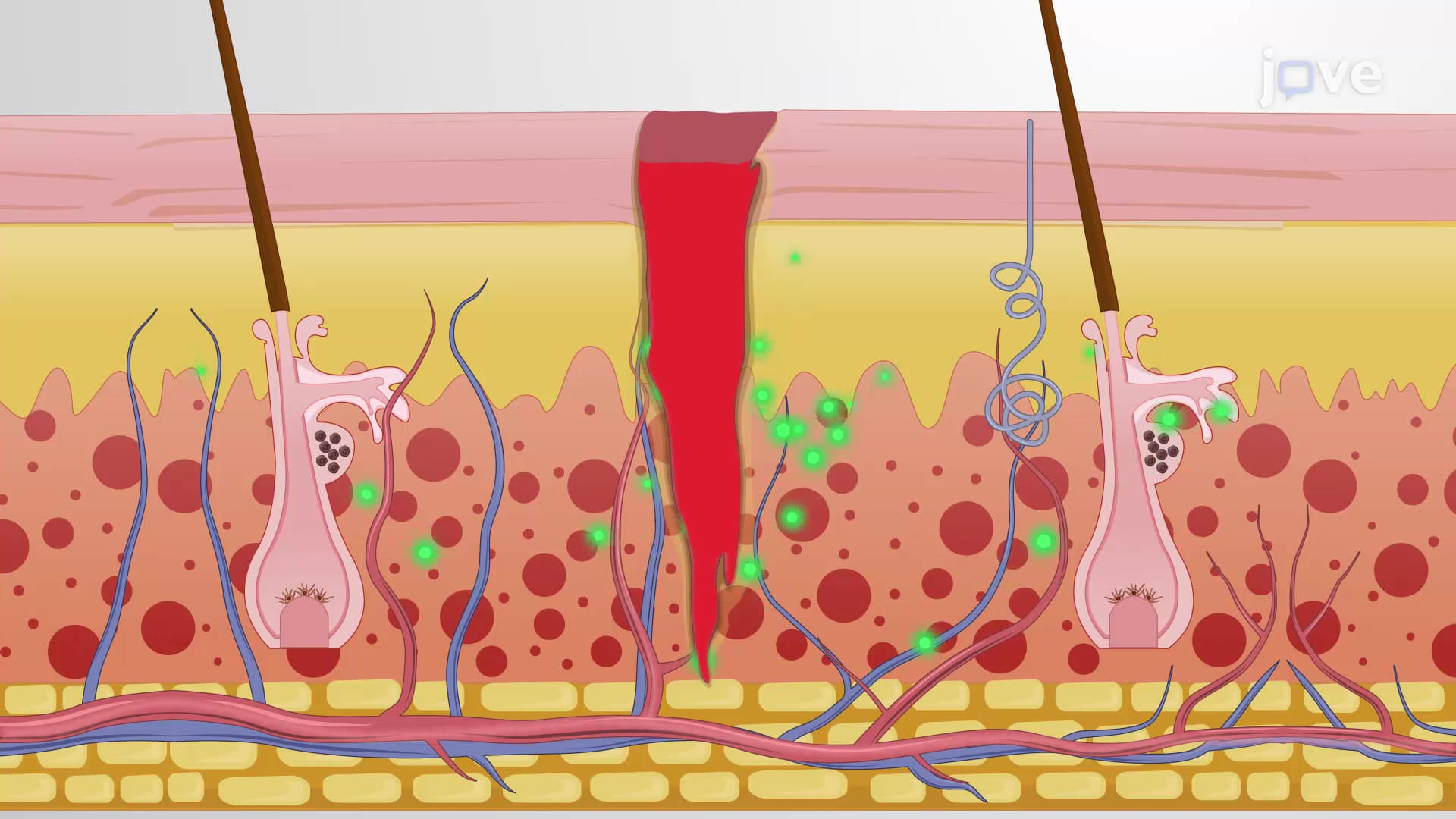 Phases of Wound Repair