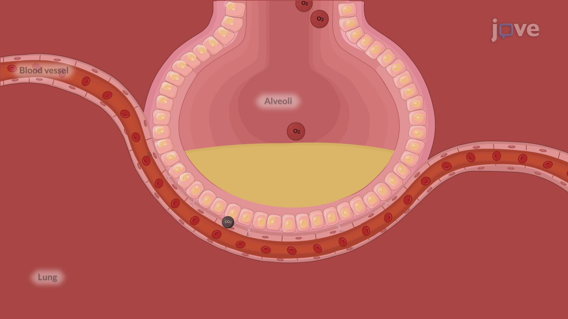 Acute Respiratory Failure-I